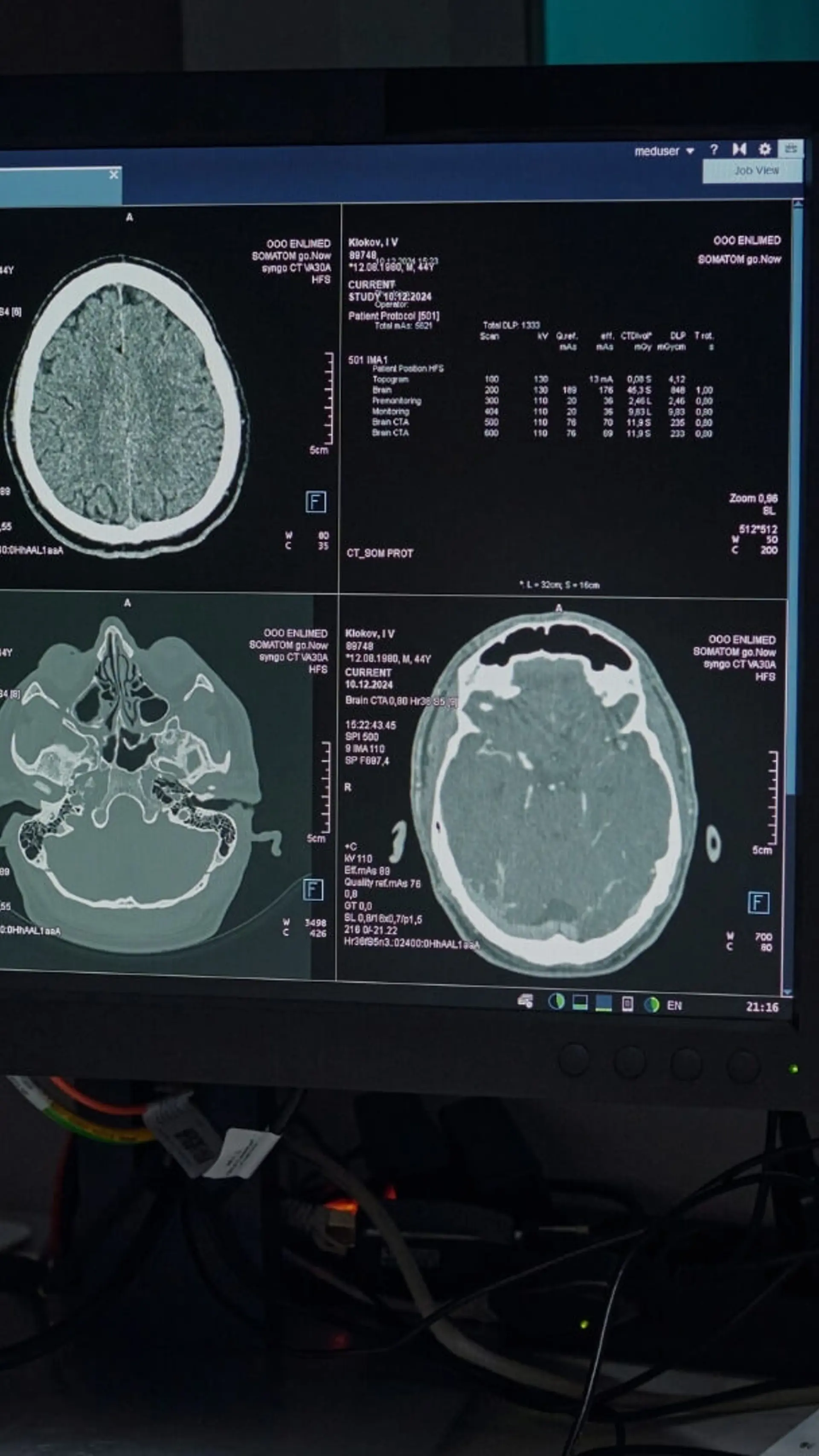 Neuropsychologie und Neurowissenschaft